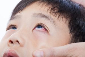 Ketahui Jenis Penyakit Mata Paling Umum