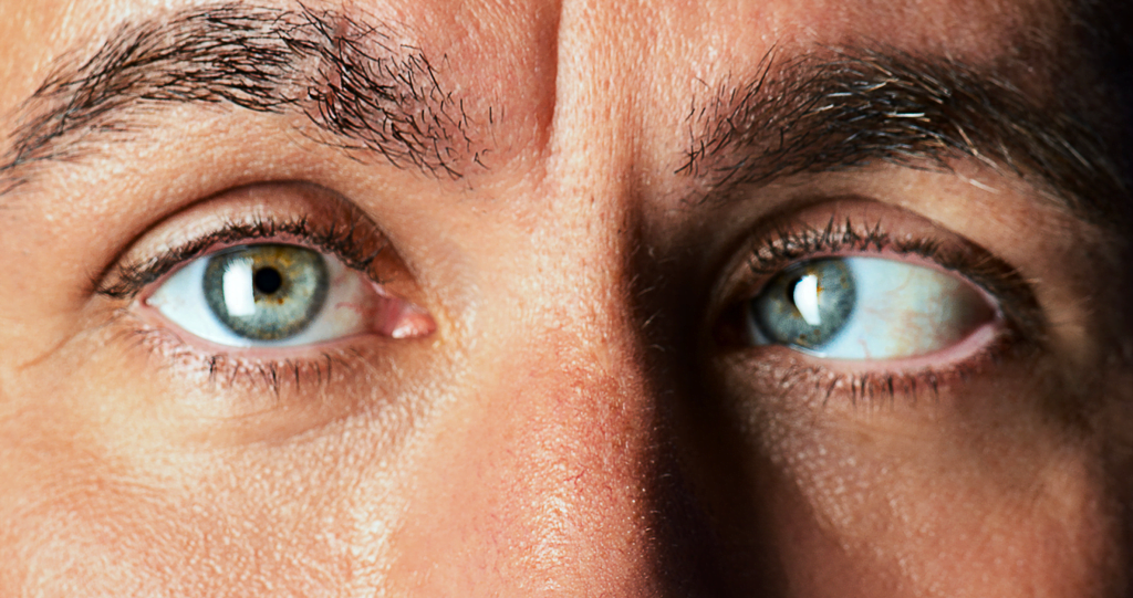 Perbaiki Masalah Gangguan Mata Juling dengan Terapi di Klinik Mata