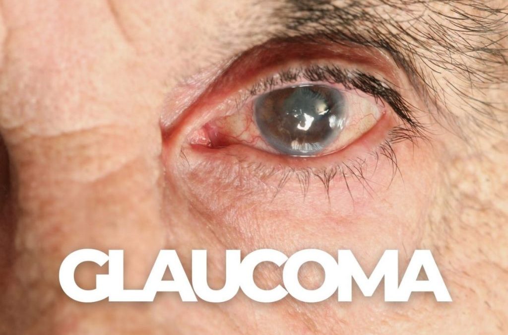 Glaucoma Salah Satu Gangguan Mata yang Perlu Diwaspadai