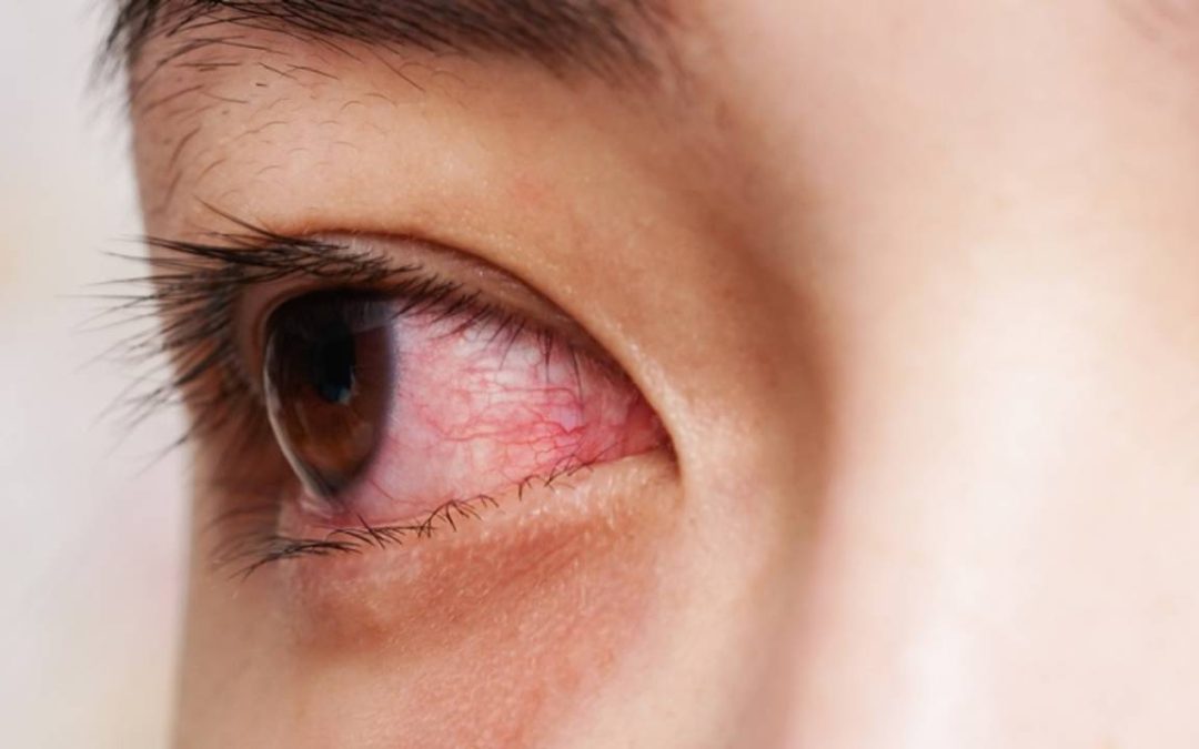 Mengenal Berbagai Jenis Penyakit yang Menyerang Retina Mata