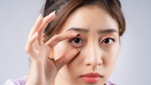 Mata Malas pada Orang Dewasa: Ketahui Perawatan Modern untuk Amblyopia