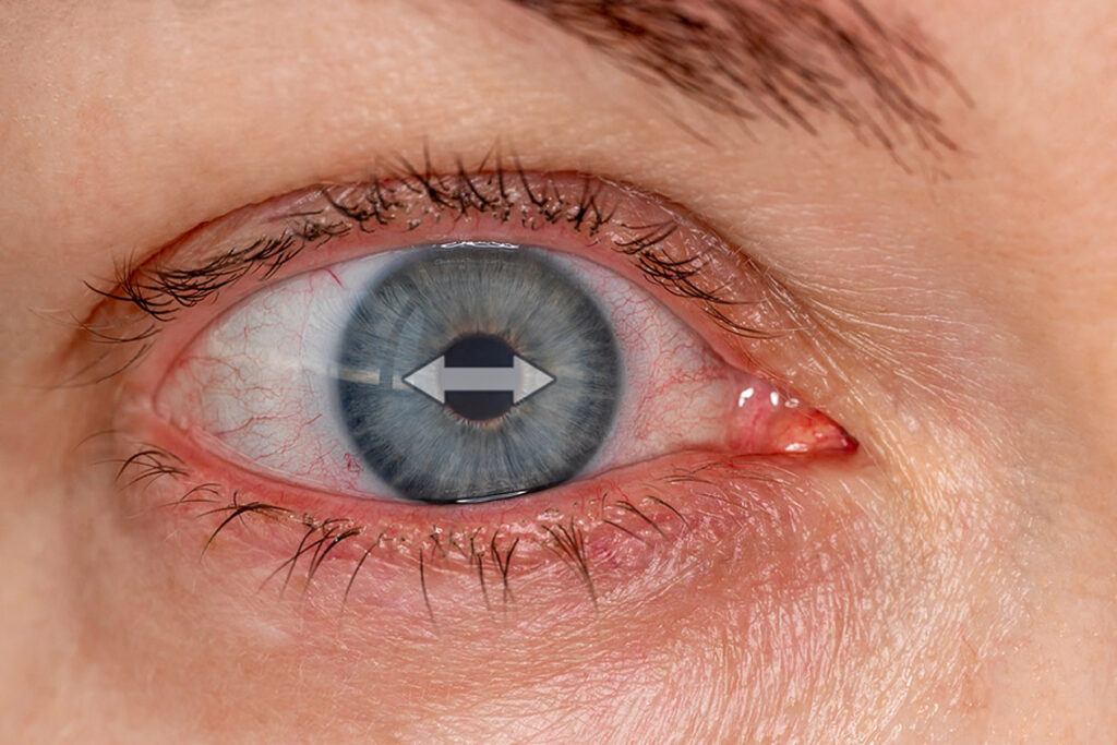 Apa yang Terjadi pada Mata saat Anda Tidur? Mengenal Rapid Eye Movement