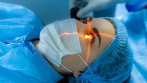 Risiko dan Komplikasi Umum yang Bisa Terjadi Setelah Operasi Laser Mata