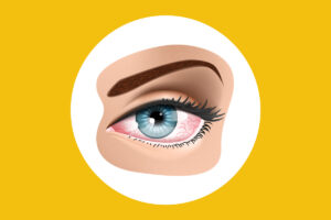 Kekurangan Vitamin dan Risiko Masalah Penglihatan yang Perlu Diwaspadai