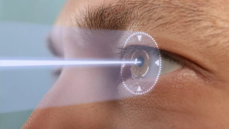 Ketakutan Nyeri dan Gangguan Mata Pasca LASIK pada Mata Kering? Begini Fakta dan Solusinya