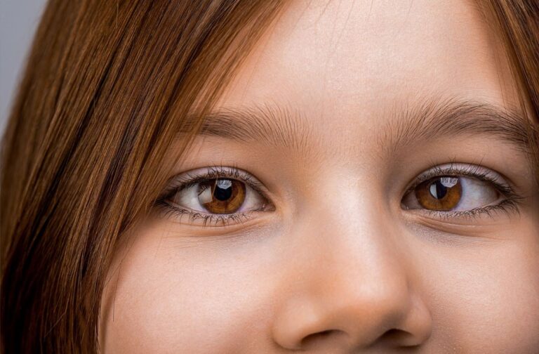 Benarkah Ada Terapi untuk Sembuhkan Mata Juling? Ketahui Apa Saja Perawatannya?