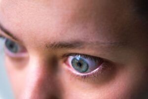 Mata Menonjol dan Sulit Berkedip? Ini Penyebab dan Cara Mengatasinya