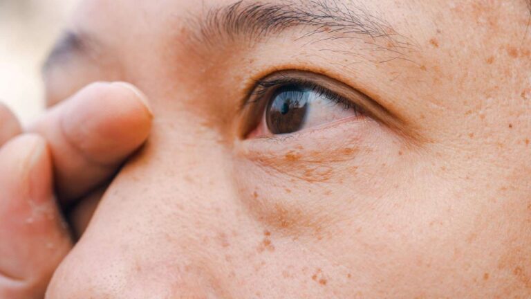 Penglihatan Kabur pada Satu Mata Tiba-Tiba? Ini Penyebab yang Sering Diabaikan