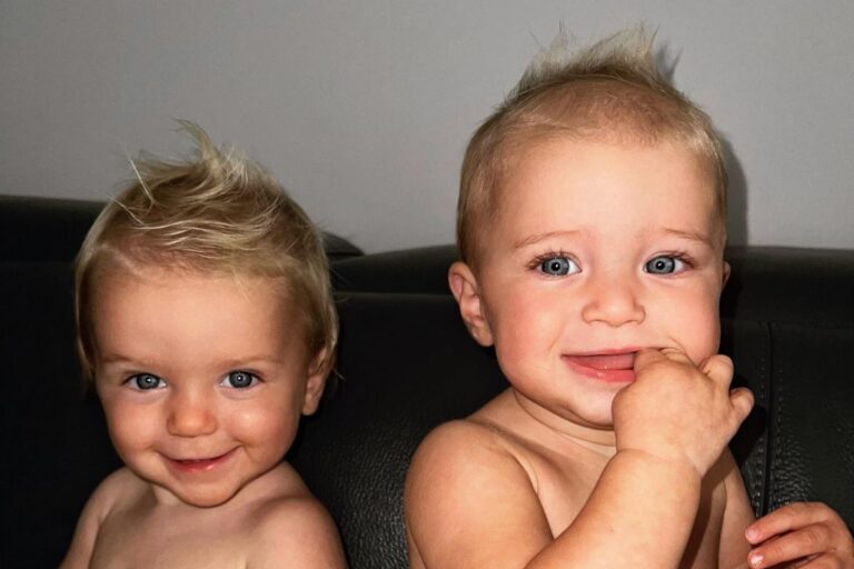 Apakah Kembar Bisa Punya Warna Mata Berbeda? Begini Penjelasannya!