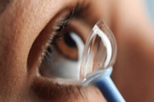 Jangan Asal Pakai! 5 Kebiasaan Penting agar Skleral Lens Tetap Nyaman dan Aman