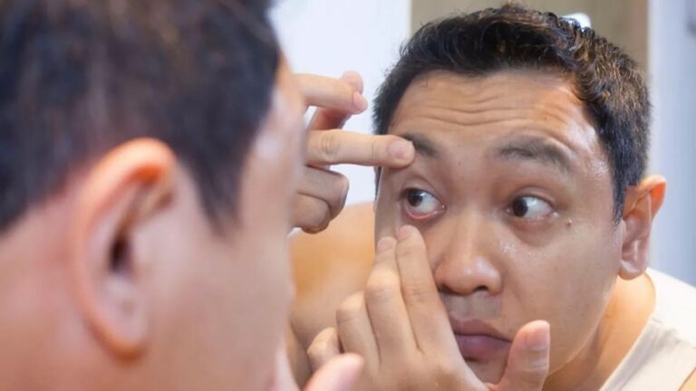 Mata Buram pada Pengidap Diabetes: Penyebab, Penanganan, dan Cara Mencegah Kehilangan Penglihatan