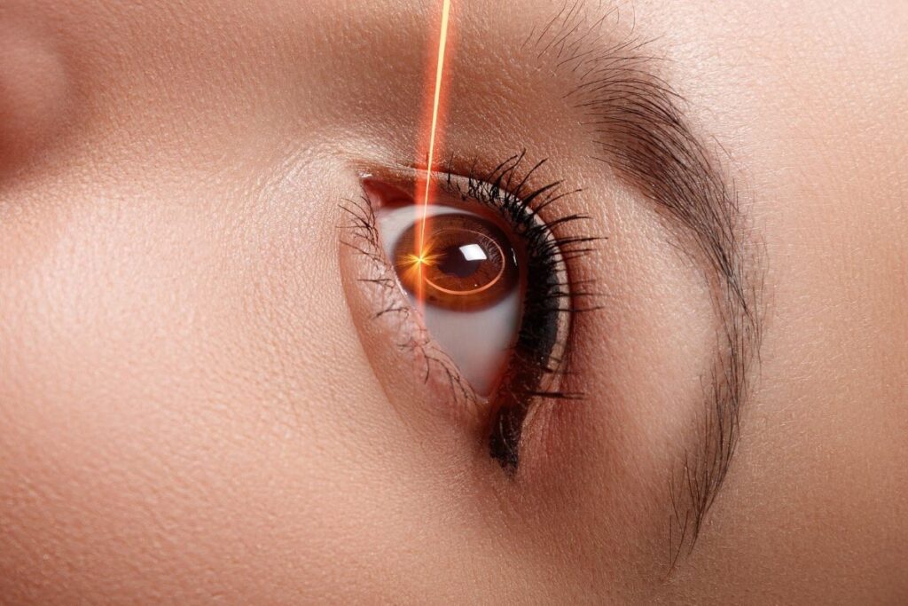 Minus Tinggi Sampai Belasan? Ini Alasan LASIK Belum Tentu Jadi Solusi Terbaik