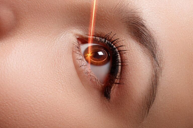Minus Tinggi Sampai Belasan? Ini Alasan LASIK Belum Tentu Jadi Solusi Terbaik