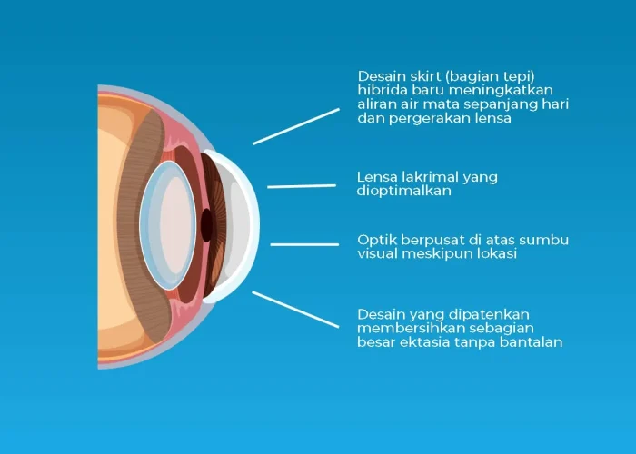 Hybrid-Lens