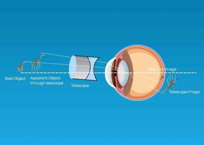 Telescope-Lens